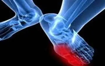  بیماری شایع مردان چیست؟ + علایم