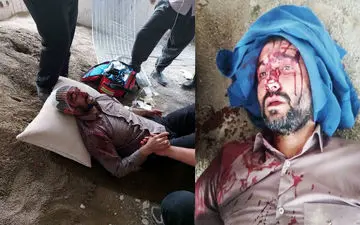 جزئیات قمه خوردن شهردار ناحیه ۳ منطقه ۱۹ در محله خلازیر / ضاربان بازداشت شدند + عکس 