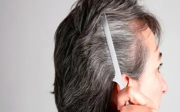  علت سفید شدن زودرس مو‌ها چیست؟