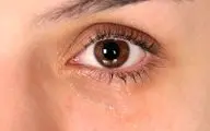 خشکی چشم چگونه درمان می‌شود؟