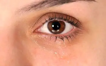 چشماهیتان را با این دلایل ماساژ ندهید