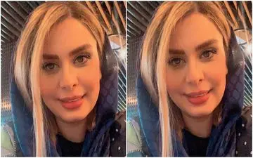 عکسی از تغییر ۱۸۰ درجه ای چهره نجمه جودکی| نجمه خانم انگار جدایی از صدا و سیما بهت ساخته!