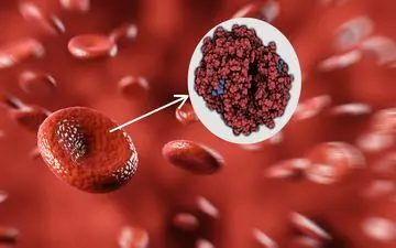 علائم و درمان کم خونی!