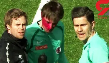 تماشاگر فوتبال داور مسابقه را کور کرد! + عکس