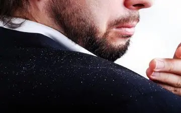  خود درمانی برای شوره سر ممنوع! 