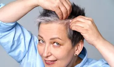 اگر موهایتان سفید شده بخوانید: ارتباط شگفت‌انگیز سفیدی مو با سرطان پوست فاش شد!