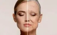بهترین زمان شروع استفاده از محصولات ضدپیری چه وقت است؟