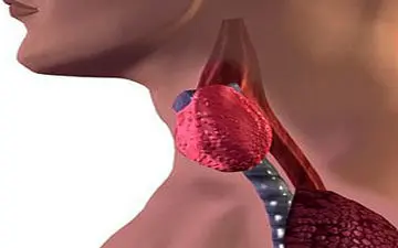 حقایقی ناشناخته در مورد غده ی تیروئید و گواتر