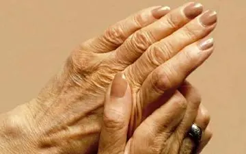 ۷ دلیل پیر شدن دست‌ها