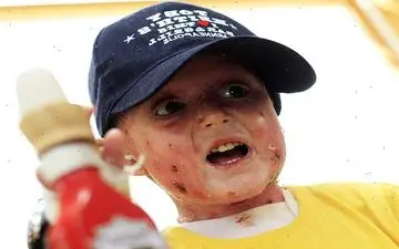 وزیر بهداشت:این بیماری درمان قطعی ندارد