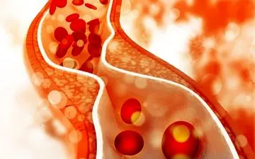 رگ های قلبتان را با این خوراکی ها از همیشه تمیزتر کنید