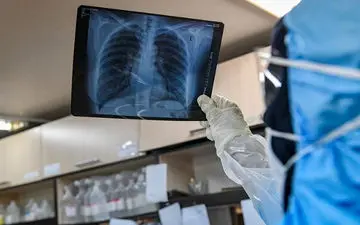 شرایط پل دختر نگران کننده است!