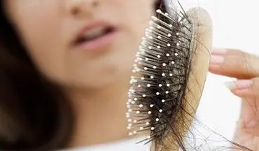 دلایل ریزش مو در زنان 
