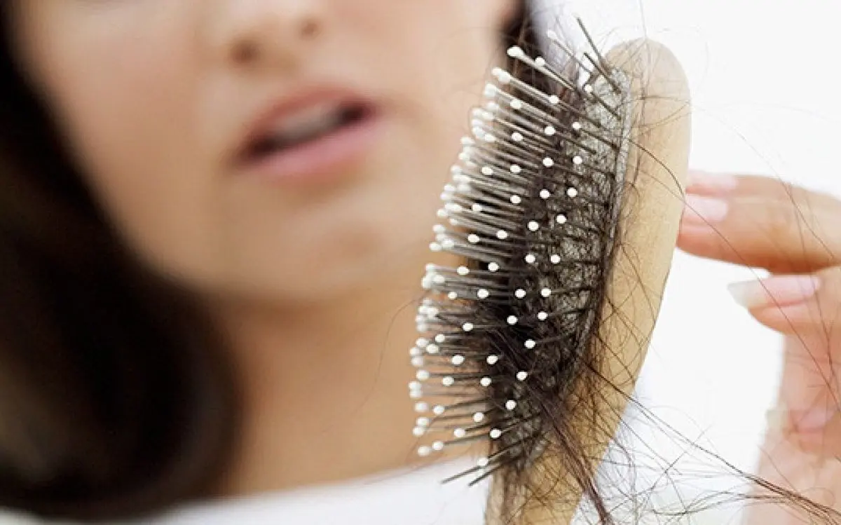 دلایل ریزش مو در زنان 