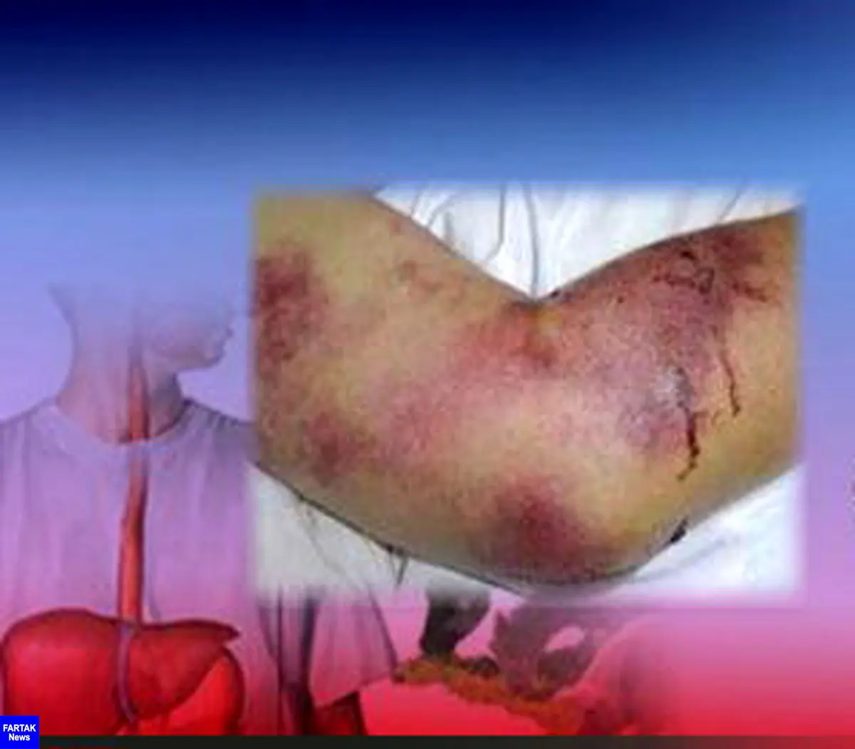 هشدار شبکه دامپزشکی مشهد در خصوص بیماری تب خون‌ریزی دهنده کریمه کنگو
