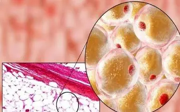 دیگر گرسنگی معنا ندارد! کشفِ سیستئین، قهرمانِ چربی‌سوزی