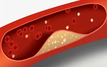 خوراکی‌هایی که فشار خون را پایین می‌آورد + فیلم
