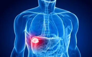 علایم شایع بیماری کبد 