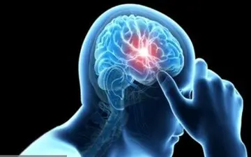 هشدار؛ خطر نوعی سکته مغزی نادر در خانم‌ها 