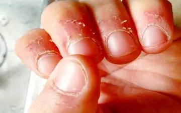 ناخن هایتان را می جوید؟ بیا تا یه حقایقی برات بگم!