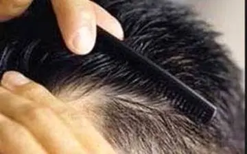 افزایش رشد موها با این روغن خاص