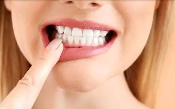 عقب نشینی لثه‌ها را جدی بگیرید| معایب تمیز کردن عمیق دندان چیست؟



