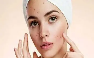 تاثیر منفی خودارضایی بر چهره