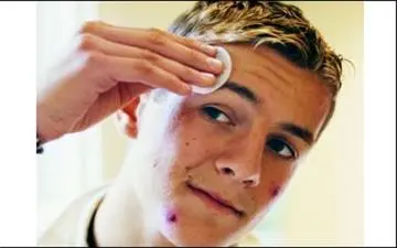 غذاهایی که ممکن است دلیل اصلی جوش زدنتان باشند