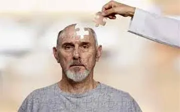 زوال عقل از اواخر ۴۰‌سالگی شروع می‌شود
