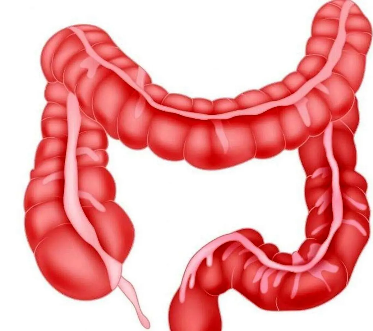 معجزه مصرف این گیاه برای سلامت روده شما که از آن بی خبرید