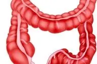 معجزه مصرف این گیاه برای سلامت روده شما که از آن بی خبرید
