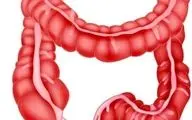 معجزه مصرف این گیاه برای سلامت روده شما که از آن بی خبرید