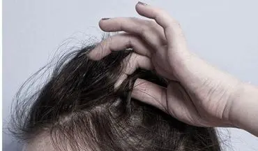 موهای خود را بی‌دلیل از دست می‌دهید؟/ این علت‌ها را تا حالا نشنیده‌اید
