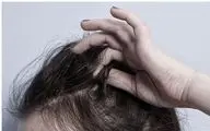 موهای خود را بی‌دلیل از دست می‌دهید؟/ این علت‌ها را تا حالا نشنیده‌اید