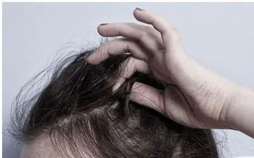 موهای خود را بی‌دلیل از دست می‌دهید؟/ این علت‌ها را تا حالا نشنیده‌اید