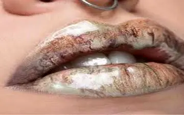  لب هایی قلوه ای و حجیم | این ادویه لب‌های شما را قلوه‌ای و حجیم می‌کند