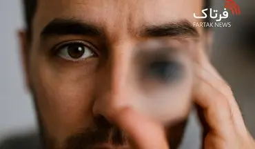تاری دید؛ از علل ساده تا هشدارهای جدی برای سلامت چشم