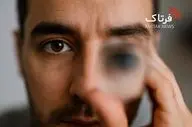 تاری دید؛ از علل ساده تا هشدارهای جدی برای سلامت چشم