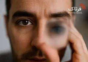 تاری دید؛ از علل ساده تا هشدارهای جدی برای سلامت چشم