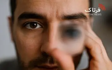 تاری دید؛ از علل ساده تا هشدارهای جدی برای سلامت چشم