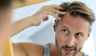 بهترین راههای جلوگیری از ریزش موی مردان