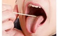 زبان تان زردرنگ است؟ بخوانید