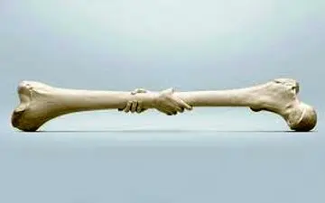 چگونه استخوان هایمان را محکم تر کنیم؟