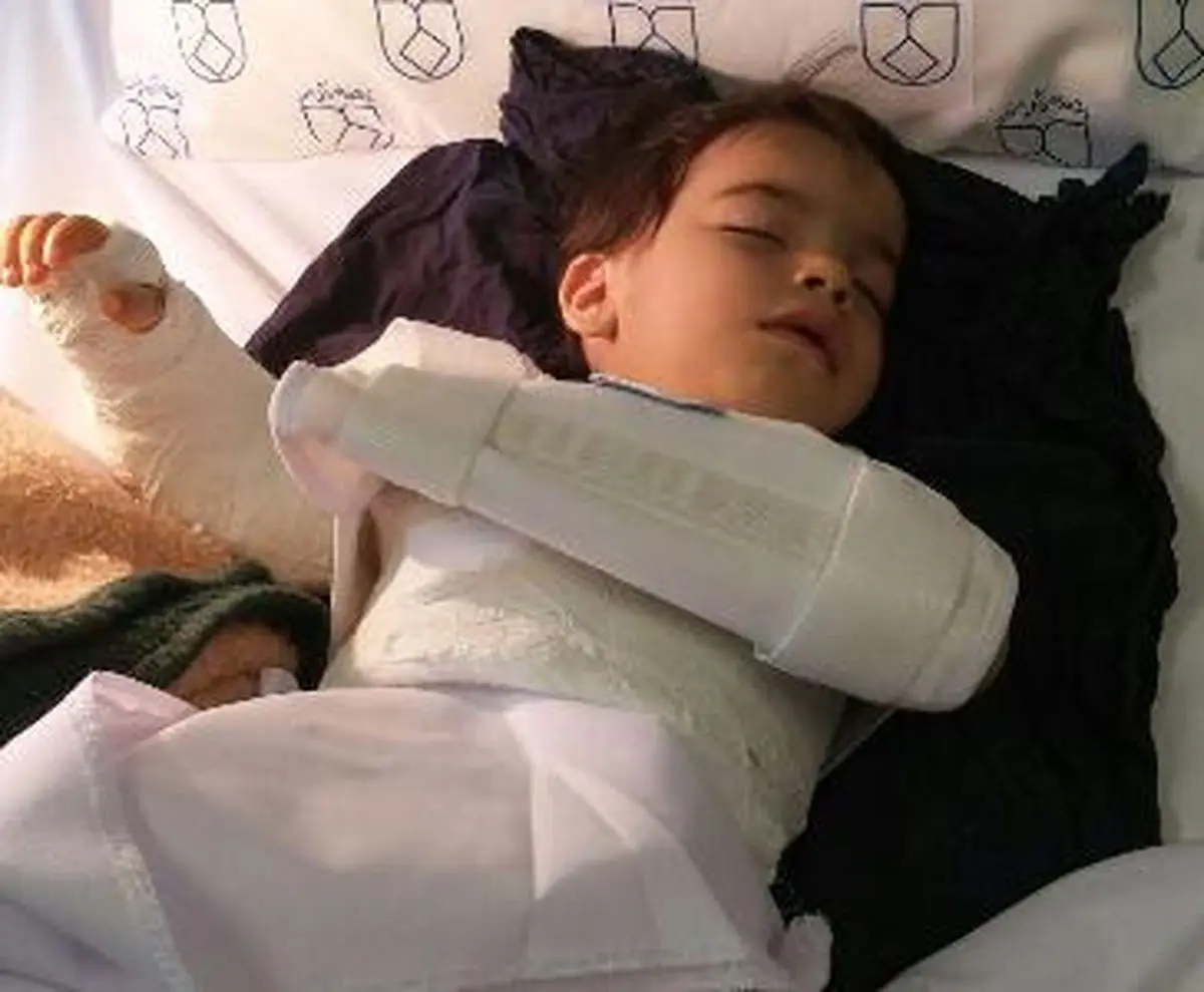 اشتباه فجیع پزشکی/دست چپ کودک اصفهانی به جای دست راستش جراحی شد ! 
