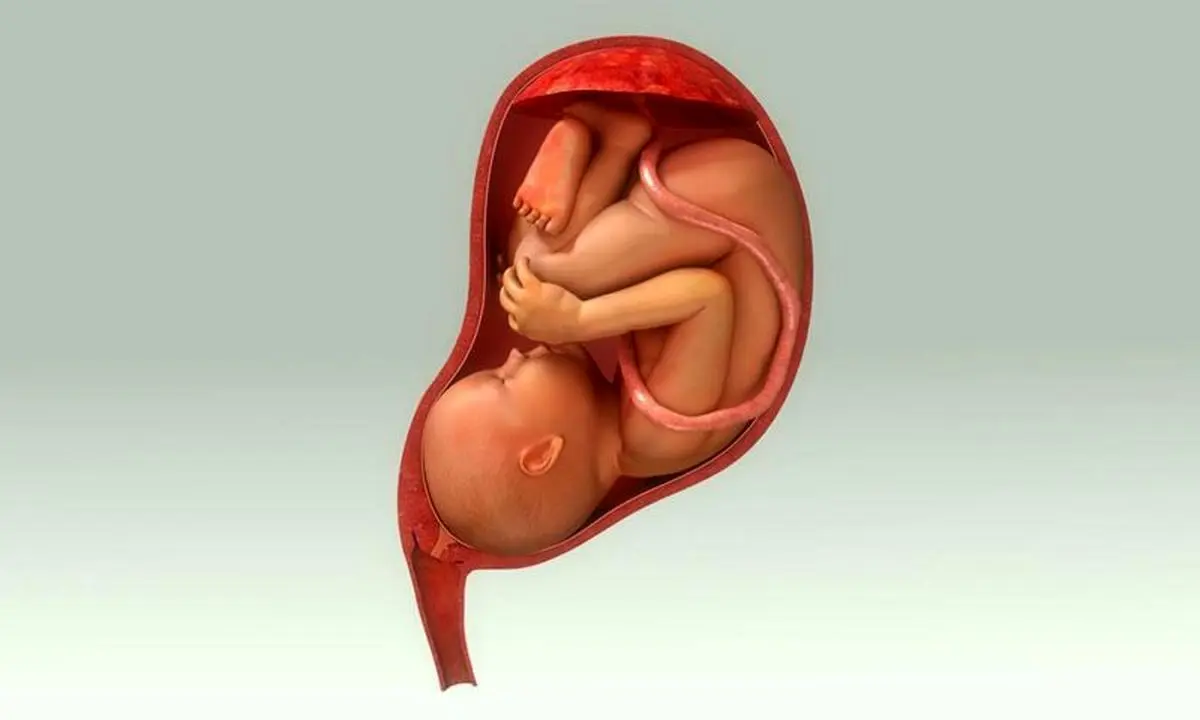 چه زمانی سرکلاژ دهانه رحم ضروری است و چرا دهانه رحم بخیه می‌شود؟