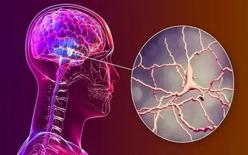 نتایج امیدوارکننده یک ساختار نانویی برای مقابله با پارکینسون

