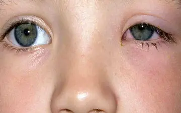 ساختمان و عملکرد چشم را بشناسید