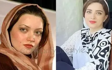 بهنوش طباطبایی با 100 میلیون دگرگون شد | چهار عمل زیبایی که بهنوش طباطبایی را جوان کرد + عکس