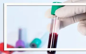 هشدار زودهنگام کرون با یک آزمایش خون ساده