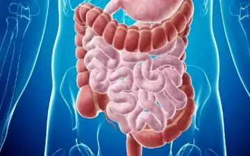درمان سرطان روده با گیاه دارویی